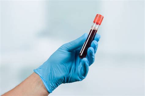 reasons  blood tests  important understanding blood tests ithrive