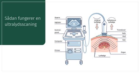 Hvad Er Ultralyd Austad Diagnostik