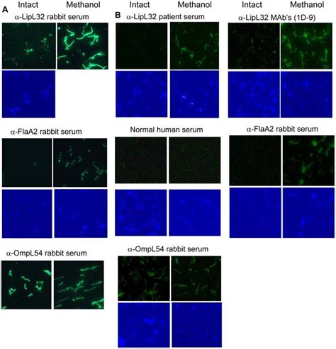 Localization Of LipL32 By Surface Immunofluorescence Assay IFA