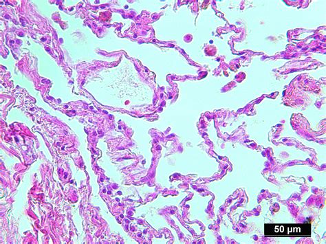 Normal Lung Tissue Histology