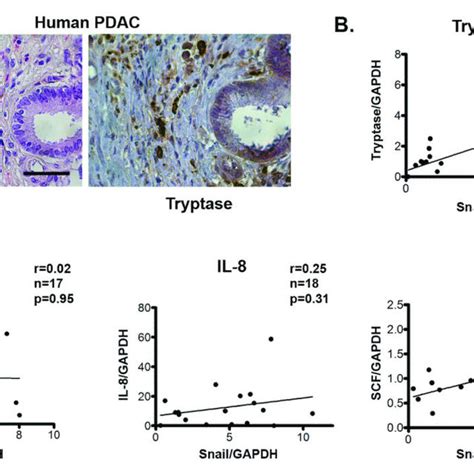 Snail Expression In Human Pdac Tumors Correlates With Mast Cell Download Scientific Diagram