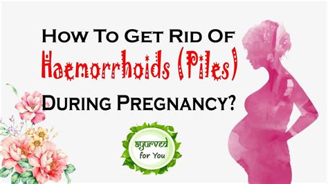 How To Get Rid Of Piles Haemorrhoids During Pregnancy Youtube