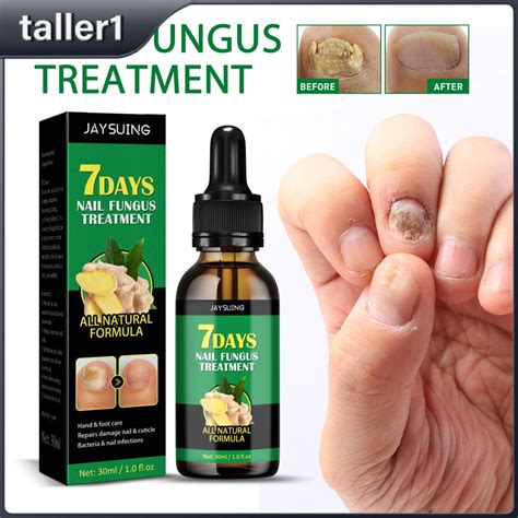 Nails Care Repair Nail Fungal Treatment Anti Fungus Onychomycosis