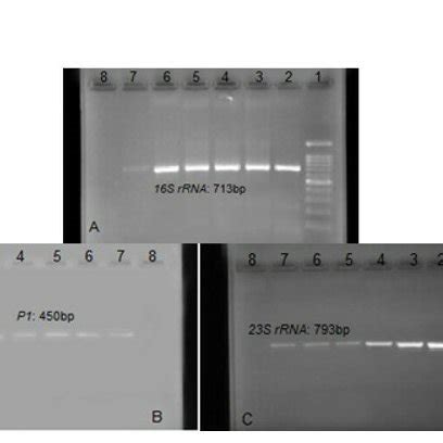 A Pcr Amplification Of The S Rrna Gene Lane Ladder Bp