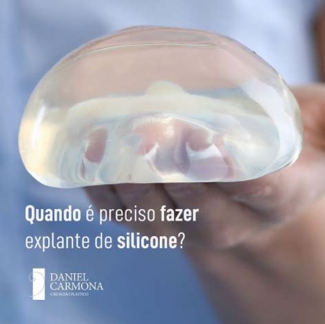 Quando Preciso Fazer Explante De Silicone Dr Daniel Carmona