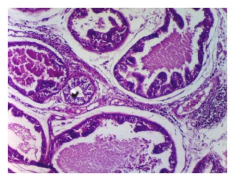 Histological Views Of Prostatic Inflammation In All Groups Normal