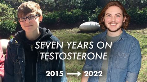 Years On Testosterone Ftm Transition Youtube