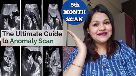 Anomaly Scan In Pregnancy Th Month Scan Between Weeks Why