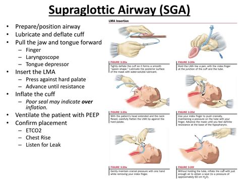 Ppt Intro To Em Airway Management Assessment And Supraglottic