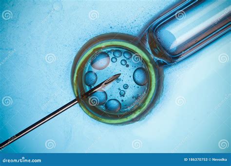 In Vitro Fertilization Process Close Up. Equipment On Laboratory Of ...