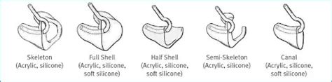 Guide To Parts Of A Hearing Aid And How They Function