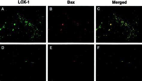 Oxidized Ldl Modulates Baxbcl 2 Through The Lectinlike Ox Ldl Receptor