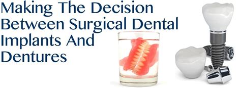 Making The Decision Between California Surgical Dental Implants And ...