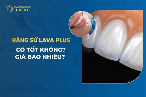 Răng Sứ Lava Plus Giá Bao Nhiêu Có Tốt Không