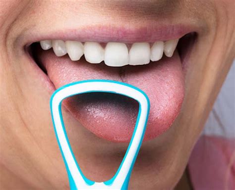 Tongue Scraping For Oral Hygiene Know Benefits From Expert Tongue