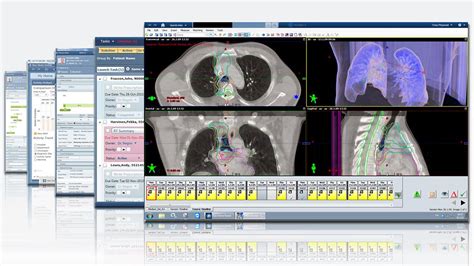 ARIA OIS Siemens Healthineers Ecuador