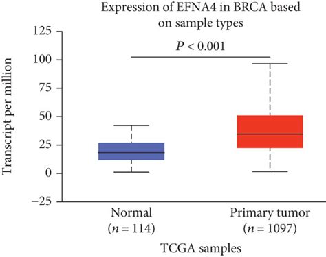 Transcriptional Levels Of Epha Efna In Breast Cancer And Paracancerous