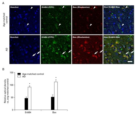 Erbb And Bax Confocal Double Immunofluorescence Staining Showing That