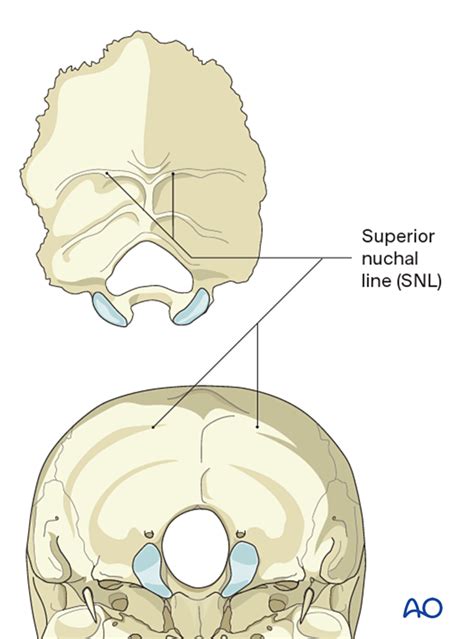 Inferior Nuchal Line Of Occiput