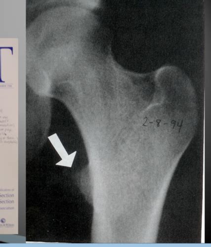 MSK Wk 14 Imaging Flashcards Quizlet