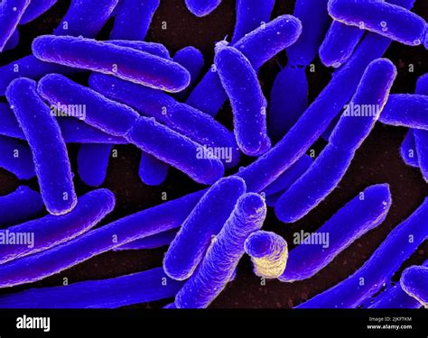 Scanning Electron Micrograph Of Escherichia Coli Stock Photo Alamy