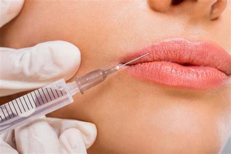 Complete Guide To Dermal Filler