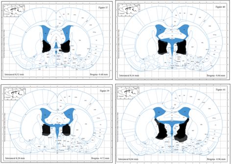 Figure 1 From Neural Circuitry Of Conditioned And Unconditioned Fear