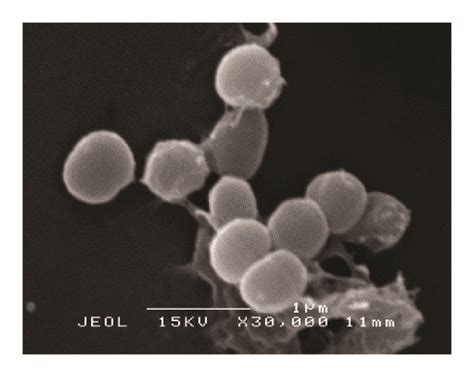 (a) Scanning electron micrograph of untreated S. aureus. (b) Scanning ... 