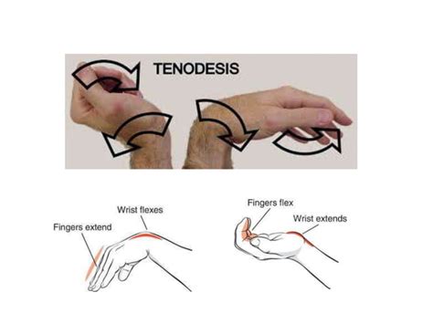 Principles Of Tendon Transfer Ppt