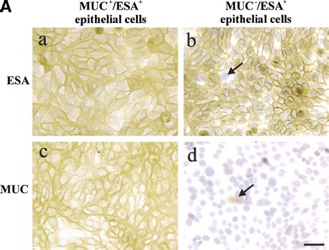 Isolation Immortalization And Characterization Of A Human Breast