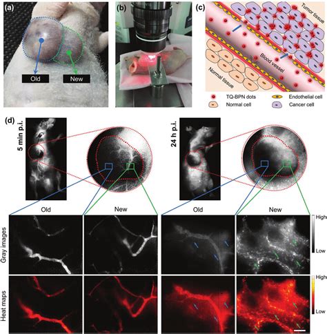 In Situ Visualization Of The Enhanced Permeability And Retention EPR