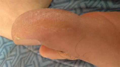 My Feet For You Pornhub Gay