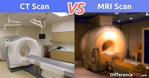 Ct Scan Vs Mri Whats The Difference Difference My Xxx Hot Girl