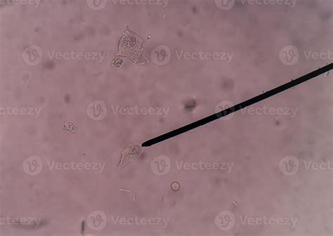 renal epithelial cells in urine. 908385 Stock Photo at Vecteezy