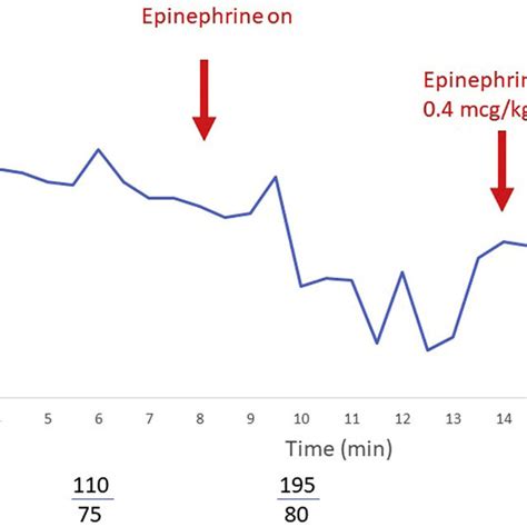 Heart Rate Trends Before During And After Epinephrine Infusion