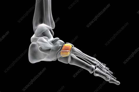 Intermediate cuneiform bone, illustration - Stock Image - F036/8568 ...