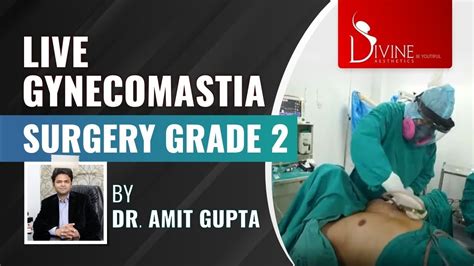 Live Gynecomastia Grade 2 With Dr Amit Gupta Divine Cosmetic Surgery