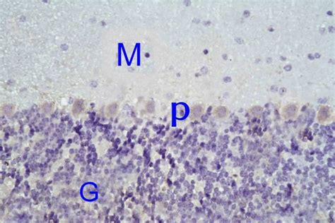 A Photomicrograph Of A Section Of The Cerebellar Cortex Of A Control Download Scientific