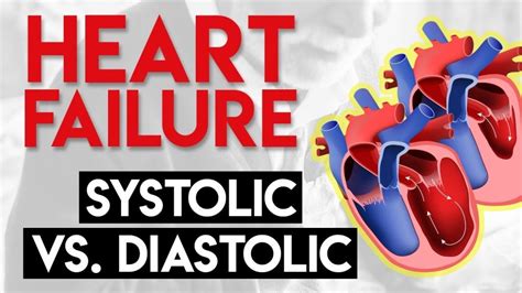 Systolic Heart Failure Causes, Symptoms, and Management