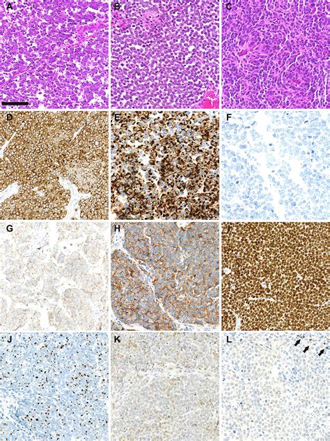 Frontiers Histogenesis Of Merkel Cell Carcinoma A Comprehensive