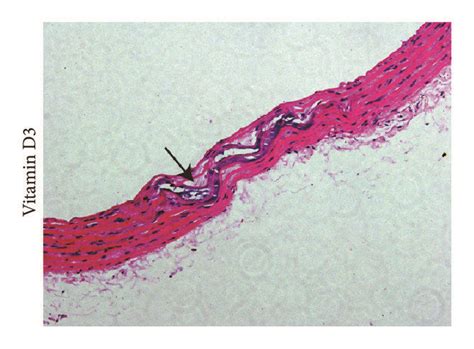 Von Kossa And Hematoxylin And Eosin He Staining For Aortic Sections Download Scientific