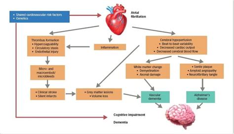 Guide To Atrial Fibrillation: Causes, symptoms and treatments