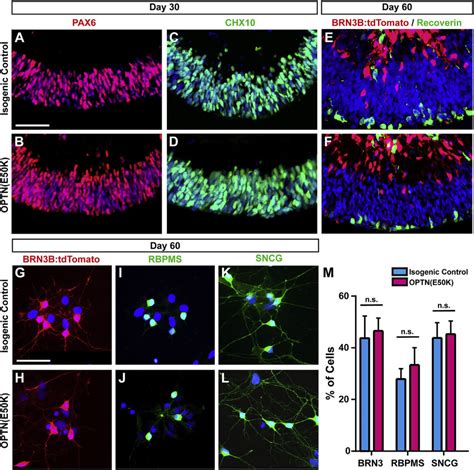 The Optne50k Mutation Does Not Affect Early Stages Of Retinal