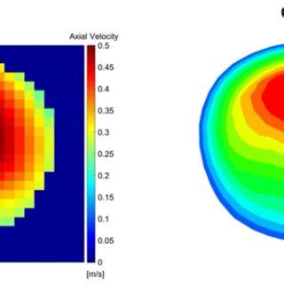 Velocity Comparison Between Pc Mri Measurements And Cfd Simulations At