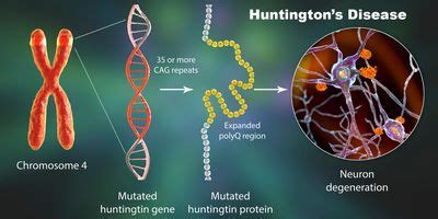 A gene therapy hope for halting Huntington’s disease | Drug Discovery News