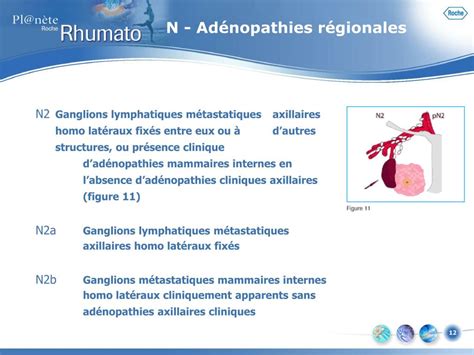 Ppt Classification Tnm Illustrée Powerpoint Presentation Free