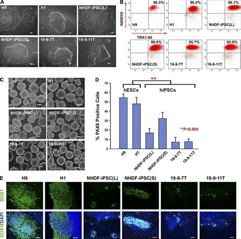 Variations in the ability of hiPSCs to undergo neuroectodermal ...