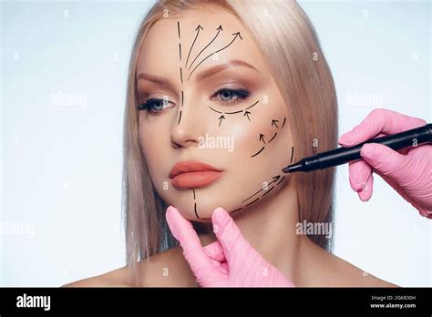 Beautiful Blonde Woman With Markings For Plastic Surgery On Her Face Stock Photo Alamy