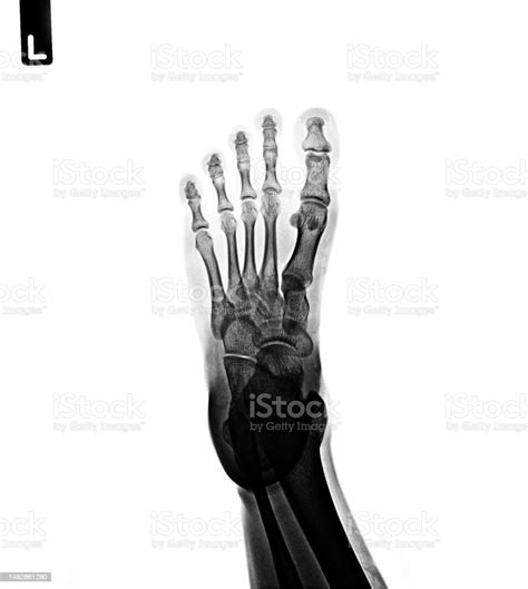 Xray Normal Human Of Foot Stock Photo Download Image Now Anatomy