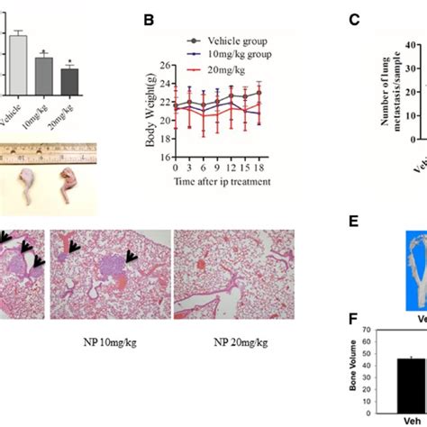 Np Inhibits Osteosarcoma Growth In Vivo Measurement Of Tumor Volume